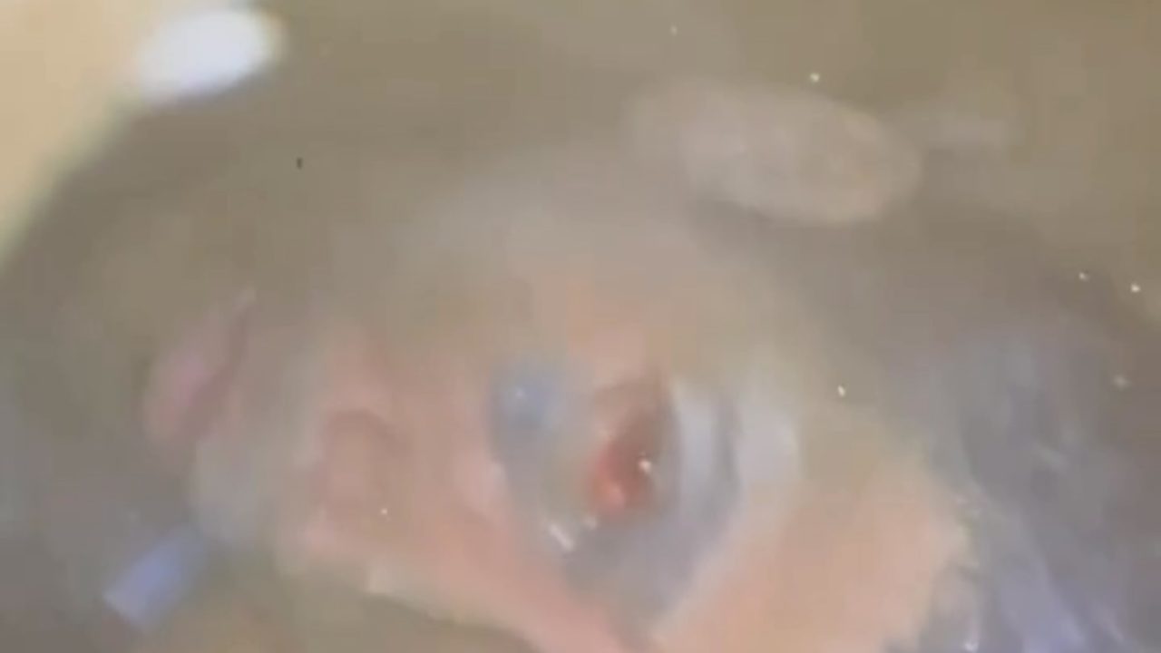 La voz que no se apagó: Tras 170 horas, rescatan rostro de sobreviviente en Catia la Mar